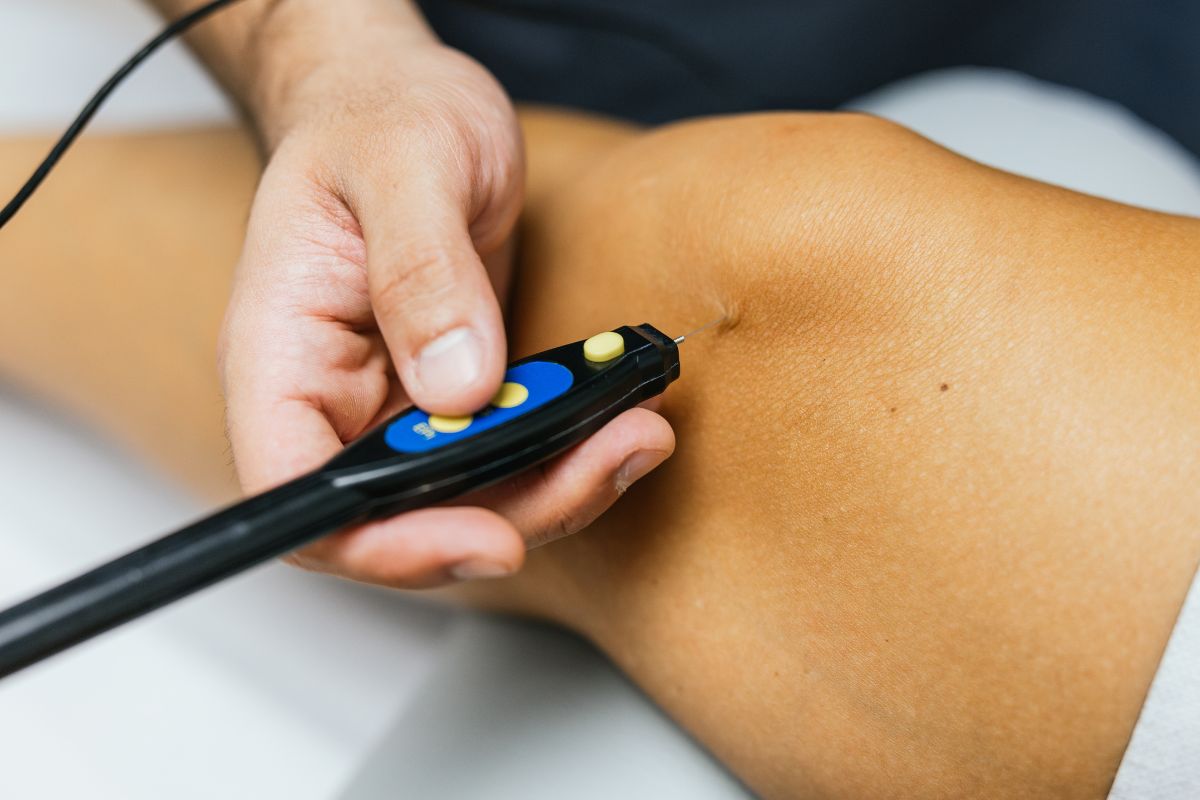 Microcurrent Therapy and Muscle Recovery: What It Does and What Remains Uncertain