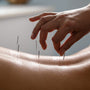 Holistic Pain Management: Acupuncture, Cupping, Nutrition & Lifestyle Tips