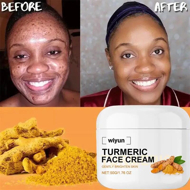 Retinol Natural Turmeric Vitamin C Whitening Face Cream Moisturizing Firming Hyaluronic Lightening Fade Fine Lines Skin Care