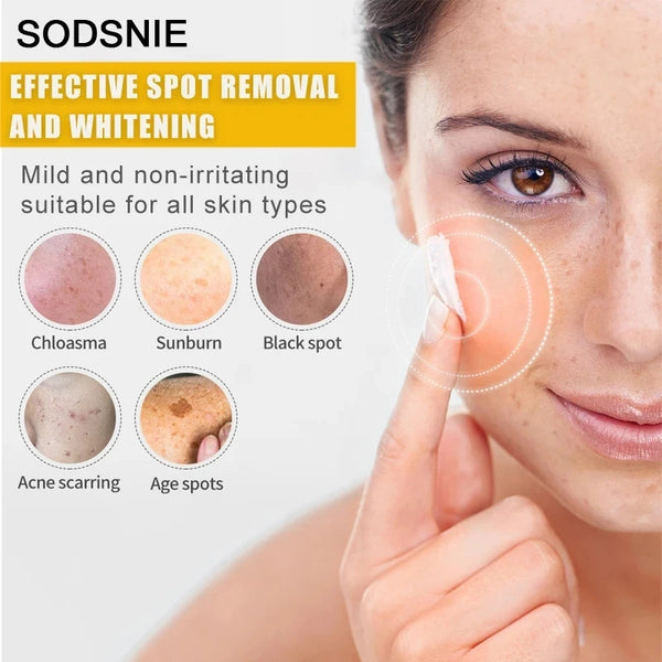 Dark Spot Remover Vitamin C Whitening Remove Melasma Freckle Sun Spots Anti-Pigmentation Improve Dullness Brighten Skin Care