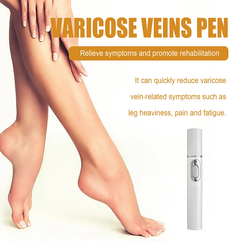 LED Therapy Pen For Varicose Veins Effective Relief Of Dilated Vasculitis In The Leg Phlebitis Health Improved Blood Circulation