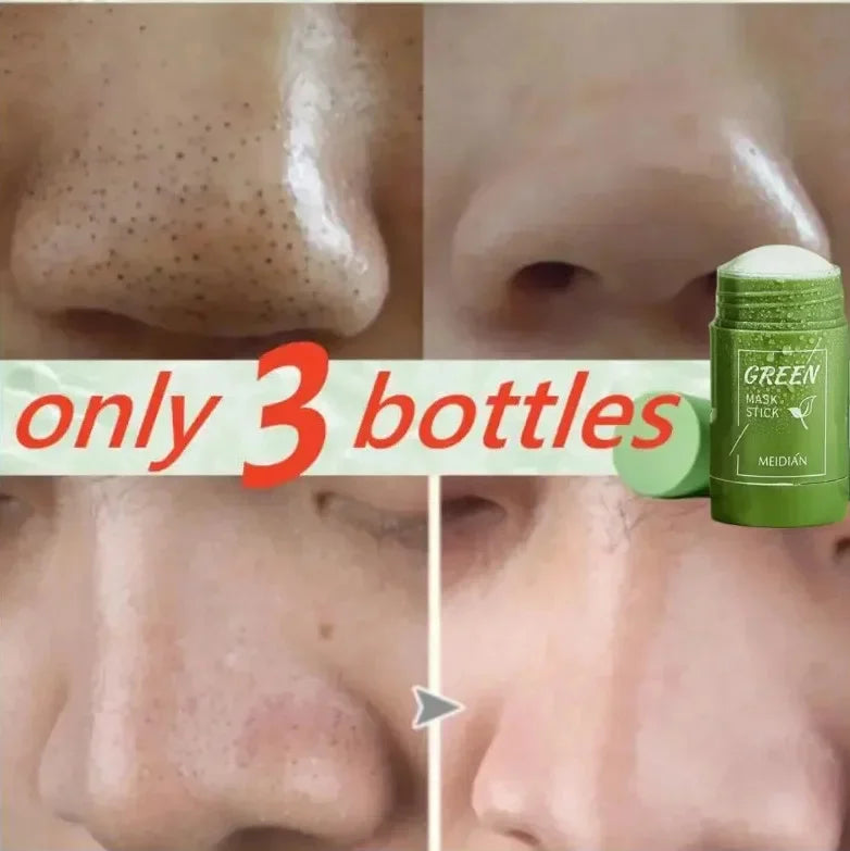 Fast Remove Blackhead Mask Green Tea Solid Cleansing Stick Facial Acne Blemish Shrink Pores Oil Control Smooth Korean Skin Care