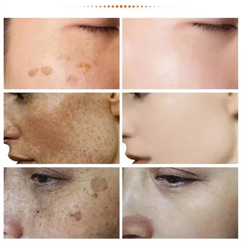 Niacinamide Face Melasma Brighten Cream Reduce Melanin Chloasma Stain Corrector Dark Skin Brighten Emulsion Moisturize Skin Care