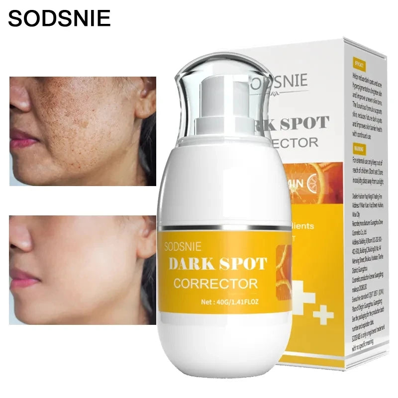 Dark Spot Remover Vitamin C Whitening Remove Melasma Freckle Sun Spots Anti-Pigmentation Improve Dullness Brighten Skin Care