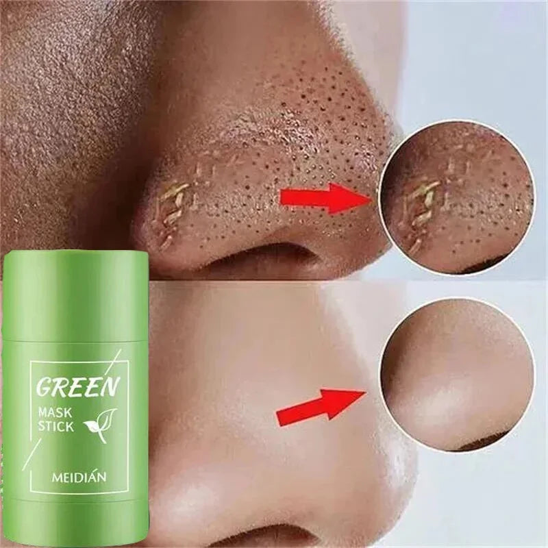 Fast Remove Blackhead Mask Green Tea Solid Cleansing Stick Facial Acne Blemish Shrink Pores Oil Control Smooth Korean Skin Care