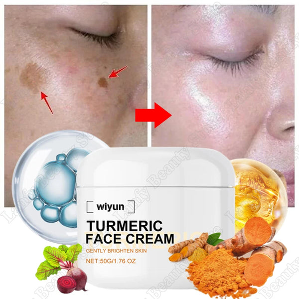 Retinol Natural Turmeric Vitamin C Whitening Face Cream Moisturizing Firming Hyaluronic Lightening Fade Fine Lines Skin Care