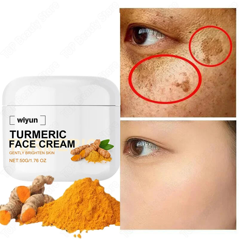 Retinol Natural Turmeric Vitamin C Whitening Face Cream Moisturizing Firming Hyaluronic Lightening Fade Fine Lines Skin Care